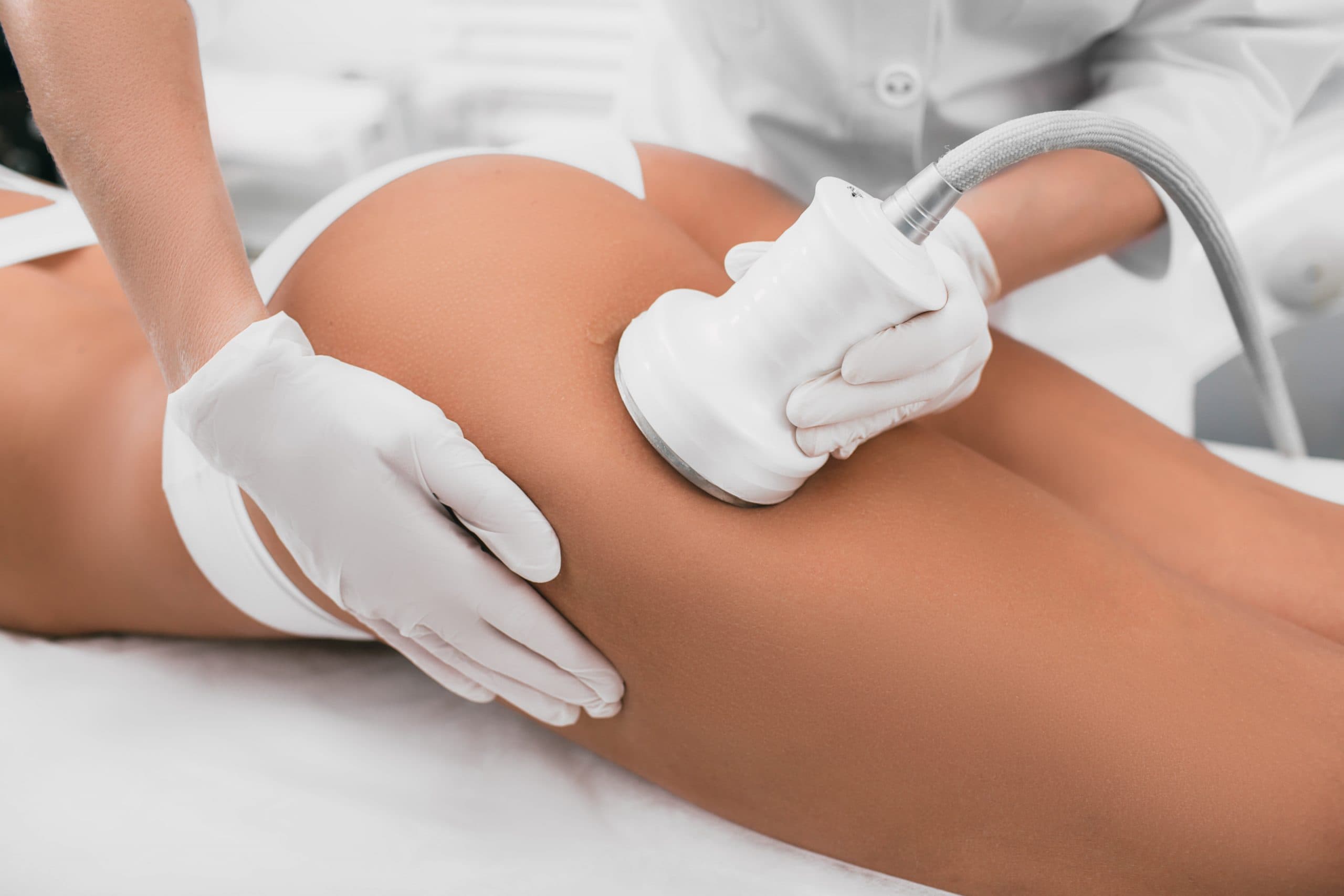 Ultrasound Liposuction All You Need To Know